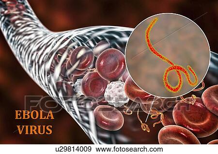 Ebola virus particles in blood, computer illustration. This virus is the cause of ebola virus disease in humans and nonhuman primates. It is a severe and often fatal disease with symptoms including fever, fatigue, muscle aches, vomiting, diarrhoea and... View Large Photo Image Stock Photo - Ebola virus particles in blood, computer illustration. This virus is the cause of ebola virus disease in humans and nonhuman primates. It is a severe and often fatal disease with symptoms including fever, fatigue, muscle aches, vomiting, diarrhoea and.... Fotosearch