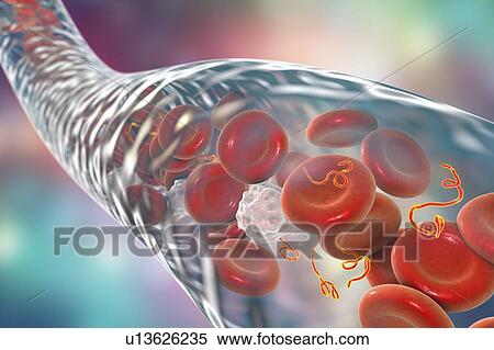 Ebola virus particles in blood, computer illustration. This virus is the cause of ebola virus disease in humans and nonhuman primates. It is a severe and often fatal disease with symptoms including fever, fatigue, muscle aches, vomiting, diarrhoea and... View Large Photo Image Stock Photography - Ebola virus particles in blood, computer illustration. This virus is the cause of ebola virus disease in humans and nonhuman primates. It is a severe and often fatal disease with symptoms including fever, fatigue, muscle aches, vomiting, diarrhoea and.... Fotosearch