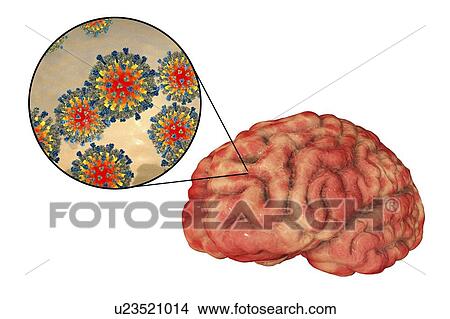 Picture - Encephalitis caused by measles viruses, computer illustration. This virus, from the Morbillivirus group of viruses, consists of an RNA (ribonucleic acid) core surrounded by an envelope studded with surface proteins haemagglutinin-neuraminidase and.... Fotosearch