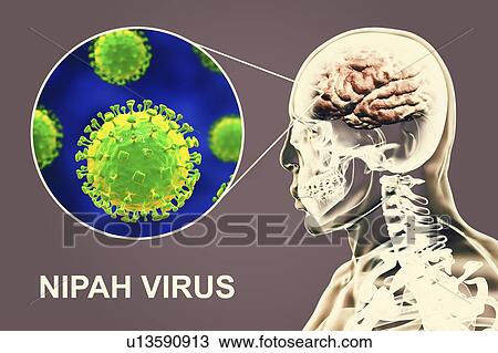 Stock Image - Encephalitis caused by Nipah viruses, computer illustration. Nipah virus is zoonotic (transmitted to humans from animals) and was first found in Malaysia and Singapore in people who had close contact with pigs. It was initially isolated in 1999 upon.... Fotosearch