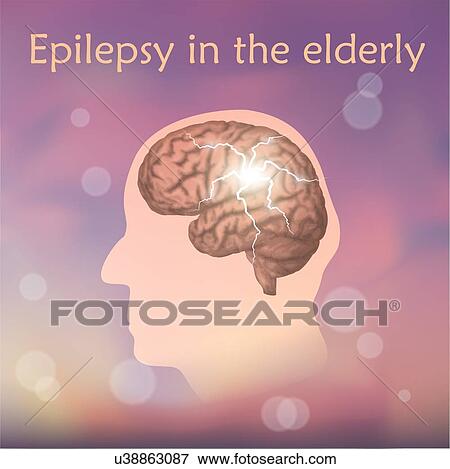 Stock Photo - Epilepsy in the elderly, illustration. Electrical discharge in an old man's brain.. Fotosearch