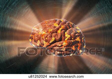 Picture - Exploding brain. Conceptual computer illustration of a human brain exploding. This image could represent mental stress or complex thought processes leading to brain overload.. Fotosearch