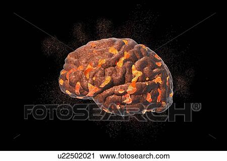 Stock Image - Exploding brain. Conceptual computer illustration of a human brain exploding. This image could represent mental stress or complex thought processes leading to brain overload.. Fotosearch
