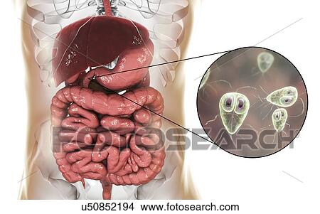Giardia lamblia in the human duodenum, computer illustration. Giardia lamblia is single-celled protozoan that has flagellae for motility. It causes the disease giardiasis (or lambliasis), an infection of the small intestine most common in tropical... View Large Photo Image Picture - Giardia lamblia in the human duodenum, computer illustration. Giardia lamblia is single-celled protozoan that has flagellae for motility. It causes the disease giardiasis (or lambliasis), an infection of the small intestine most common in tropical.... Fotosearch