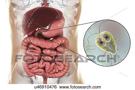 Giardia lamblia in the human duodenum, computer illustration. Giardia lamblia is single-celled protozoan that has flagellae for motility. It causes the disease giardiasis (or lambliasis), an infection of the small intestine most common in tropical... View Large Photo Image Stock Photograph - Giardia lamblia in the human duodenum, computer illustration. Giardia lamblia is single-celled protozoan that has flagellae for motility. It causes the disease giardiasis (or lambliasis), an infection of the small intestine most common in tropical.... Fotosearch