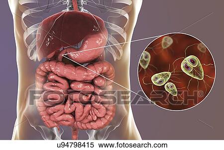Stock Photography - Giardia lamblia in the human duodenum, computer illustration. Giardia lamblia is single-celled protozoan that has flagellae for motility. It causes the disease giardiasis (or lambliasis), an infection of the small intestine most common in tropical.... Fotosearch