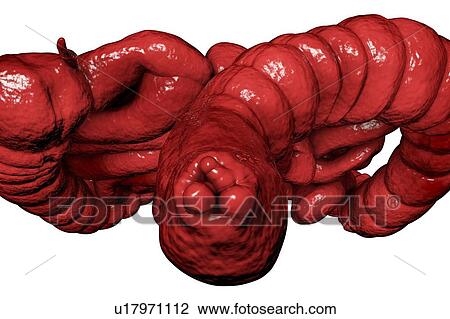 Haemorrhoids. Computer illustration of human intestines from below with haemorrhoids in the anus. View Large Photo Image Stock Image - Haemorrhoids. Computer illustration of human intestines from below with haemorrhoids in the anus.. Fotosearch