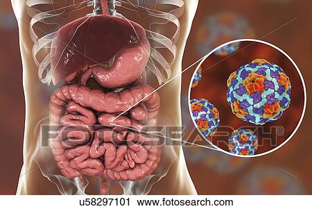 Hepatitis A viruses infecting intestine, illustration. Hepatitis A is transmitted through infected food or drink. Symptoms include influenza-like symptoms of fever and sickness, along with jaundice. View Large Photo Image Stock Image - Hepatitis A viruses infecting intestine, illustration. Hepatitis A is transmitted through infected food or drink. Symptoms include influenza-like symptoms of fever and sickness, along with jaundice.. Fotosearch