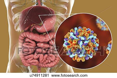 Stock Image - Hepatitis B infection. Computer illustration showing liver and close-up view of hepatitis B viruses.. Fotosearch