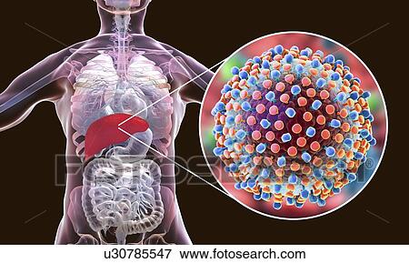 Stock Photo - Hepatitis C infection. Computer illustration showing the liver and a close-up view of hepatitis C viruses.. Fotosearch