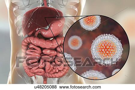 Stock Photo - Hepatitis C infection. Computer illustration showing liver and close-up view of hepatitis C viruses.. Fotosearch