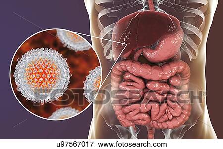 Stock Photo - Hepatitis C infection. Computer illustration showing liver and close-up view of hepatitis C viruses.. Fotosearch