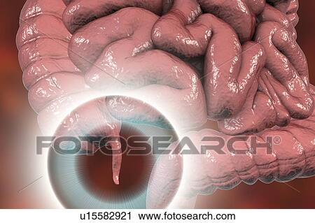 Stock Image - Human appendix, computer illustration.. Fotosearch