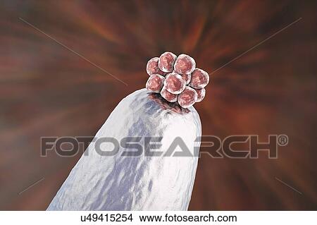 Picture - Human blastocyst on a pin tip. Conceptual computer illustration of artificial fertilization.. Fotosearch