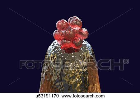 Stock Image - Human blastocyst on a pin tip. Conceptual computer illustration of artificial fertilization.. Fotosearch