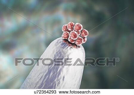 Stock Image - Human blastocyst on a pin tip. Conceptual computer illustration of artificial fertilization.. Fotosearch