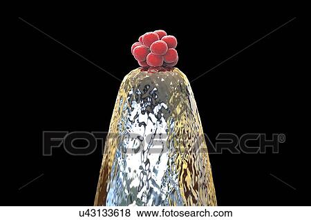 Stock Photo - Human blastocyst on a pin tip. Conceptual computer illustration of artificial fertilization.. Fotosearch