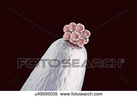 Stock Photography - Human blastocyst on a pin tip. Conceptual computer illustration of artificial fertilization.. Fotosearch