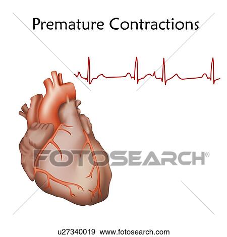 Stock Photo - Human heart contractions, illustration.. Fotosearch