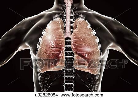 Picture - Human lungs, computer illustration.. Fotosearch