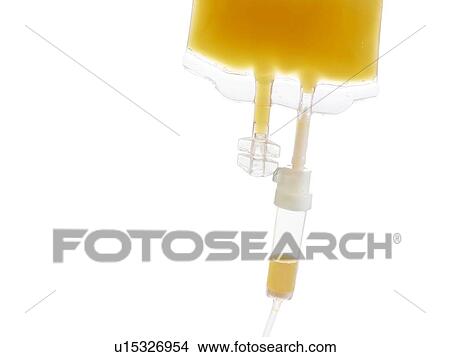 IV bag with orange juice, studio shot. View Large Photo Image Picture - IV bag with orange juice, studio shot.. Fotosearch