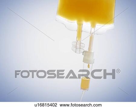 Stock Image - IV bag with orange juice, studio shot.. Fotosearch