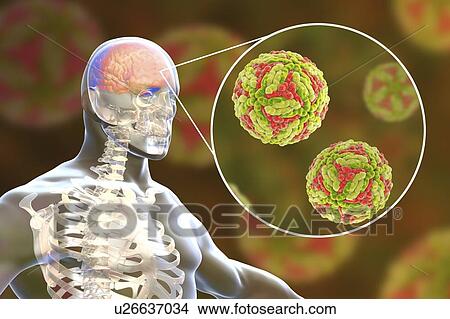 Japanese encephalitis (JE), computer illustration. JE is caused by JE virus, it is an RNA (ribonucleic acid) virus from the Flaviviridae family. It is transmitted by Culex sp. mosquito. View Large Photo Image Picture - Japanese encephalitis (JE), computer illustration. JE is caused by JE virus, it is an RNA (ribonucleic acid) virus from the Flaviviridae family. It is transmitted by Culex sp. mosquito.. Fotosearch