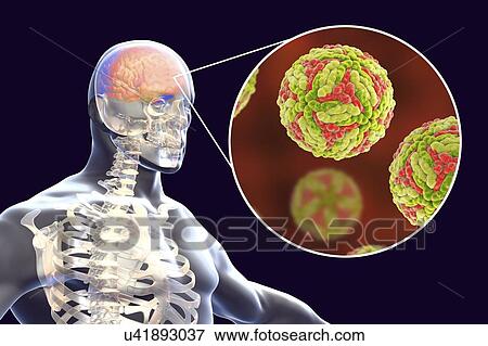 Japanese encephalitis (JE), computer illustration. JE is caused by JE virus, it is an RNA (ribonucleic acid) virus from the Flaviviridae family. It is transmitted by Culex sp. mosquito. View Large Photo Image Stock Photo - Japanese encephalitis (JE), computer illustration. JE is caused by JE virus, it is an RNA (ribonucleic acid) virus from the Flaviviridae family. It is transmitted by Culex sp. mosquito.. Fotosearch