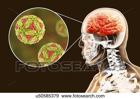 Japanese encephalitis (JE), computer illustration. JE is caused by JE virus, it is an RNA (ribonucleic acid) virus from the Flaviviridae family. It is transmitted by Culex sp. mosquito. View Large Photo Image Stock Photo - Japanese encephalitis (JE), computer illustration. JE is caused by JE virus, it is an RNA (ribonucleic acid) virus from the Flaviviridae family. It is transmitted by Culex sp. mosquito.. Fotosearch