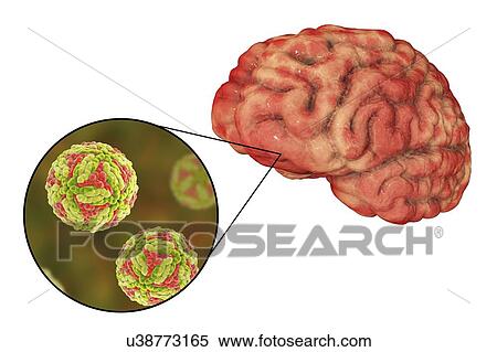 Stock Photography - Japanese encephalitis (JE), computer illustration. JE is caused by JE virus, it is an RNA (ribonucleic acid) virus from the Flaviviridae family. It is transmitted by Culex sp. mosquito.. Fotosearch