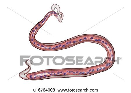 Stock Photo - Loa loa worm, computer illustration. The Loa loa worm is a parasitic nematode that lives under human skin, causing a form of filariasis called loiasis. The worms are spread by bloodsucking Chrysops flies in tropical Africa, and reach 3-7cm when.... Fotosearch