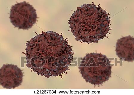Picture - Lung cancer cell, computer illustration.. Fotosearch