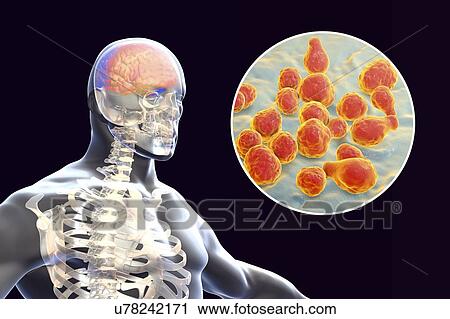 Meningitis caused by fungi Cryptococcus neoformans, computer illustration. C. neoformans is a yeast-like fungus that reproduces by budding. An acidic mucopolysaccharide capsule completely encloses the fungus. It can cause the disease cryptococcosis,... View Large Photo Image Stock Image - Meningitis caused by fungi Cryptococcus neoformans, computer illustration. C. neoformans is a yeast-like fungus that reproduces by budding. An acidic mucopolysaccharide capsule completely encloses the fungus. It can cause the disease cryptococcosis,.... Fotosearch