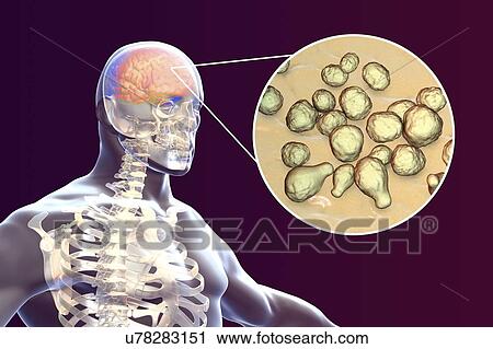 Stock Image - Meningitis caused by fungi Cryptococcus neoformans, computer illustration. C. neoformans is a yeast-like fungus that reproduces by budding. An acidic mucopolysaccharide capsule completely encloses the fungus. It can cause the disease cryptococcosis,.... Fotosearch