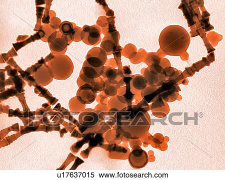 Metal nanoparticles. Coloured scanning electron micrograph (TEM) of metal nanoparticles formed by laser ablation. This research involves the use of lasers to etch and ablate metal and semiconductor surfaces. The resulting nanostructures can have... View Large Photo Image Stock Photography - Metal nanoparticles. Coloured scanning electron micrograph (TEM) of metal nanoparticles formed by laser ablation. This research involves the use of lasers to etch and ablate metal and semiconductor surfaces. The resulting nanostructures can have.... Fotosearch