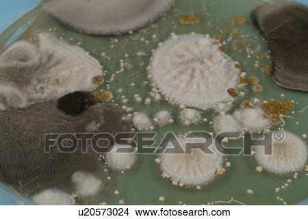 Picture - Microbes growing on agar plate.. Fotosearch