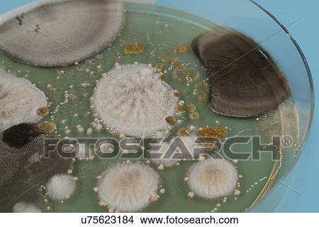Picture - Microbes growing on agar plate.. Fotosearch