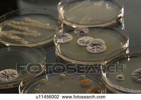 Stock Image - Microbes growing on agar plate.. Fotosearch