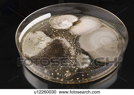 Stock Image - Microbes growing on agar plate.. Fotosearch