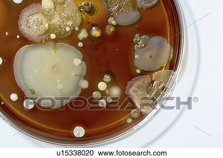 Stock Image - Microbes growing on agar plate.. Fotosearch