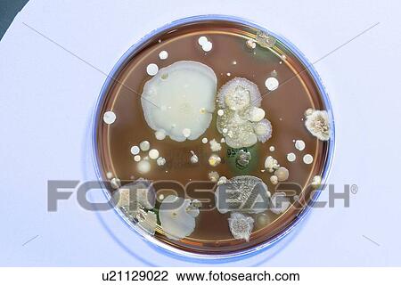 Stock Image - Microbes growing on agar plate.. Fotosearch