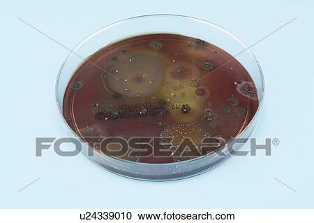 Stock Image - Microbes growing on agar plate.. Fotosearch