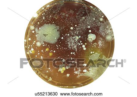 Microbes growing on agar plate. View Large Photo Image Stock Image - Microbes growing on agar plate.. Fotosearch