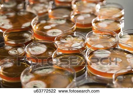 Stock Image - Microbes growing on agar plate.. Fotosearch