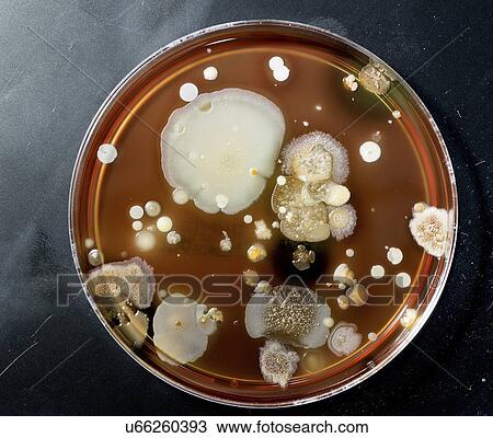 Stock Image - Microbes growing on agar plate.. Fotosearch