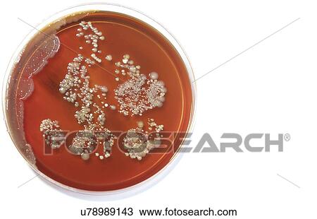 Microbes growing on agar plate. View Large Photo Image Stock Image - Microbes growing on agar plate.. Fotosearch