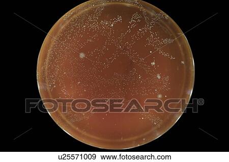 Microbes growing on agar plate. View Large Photo Image Stock Photo - Microbes growing on agar plate.. Fotosearch