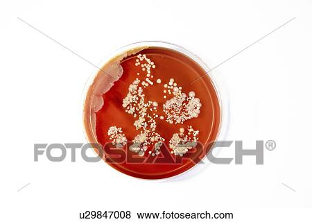 Stock Photo - Microbes growing on agar plate.. Fotosearch