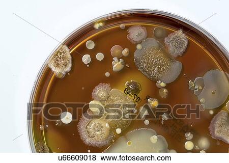 Stock Photo - Microbes growing on agar plate.. Fotosearch
