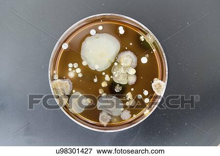 Stock Photo - Microbes growing on agar plate.. Fotosearch